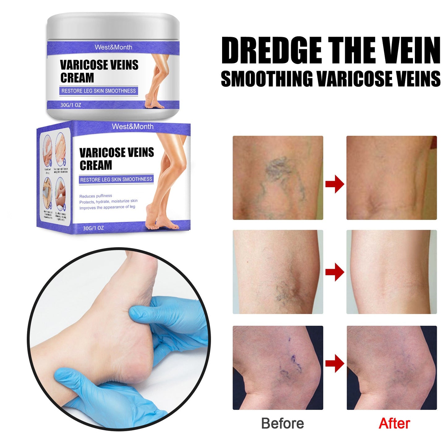 VeinCare Fading Cream